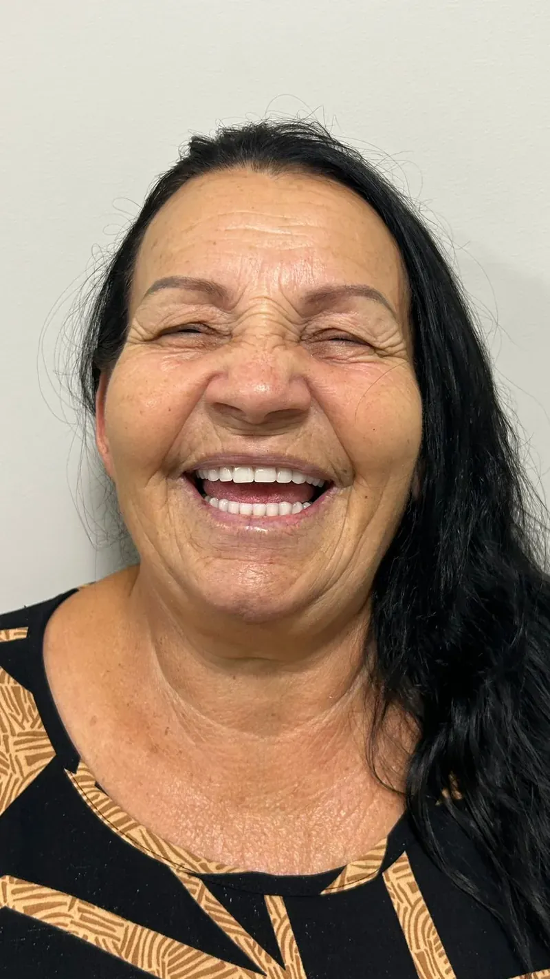 Depois — Caso 4